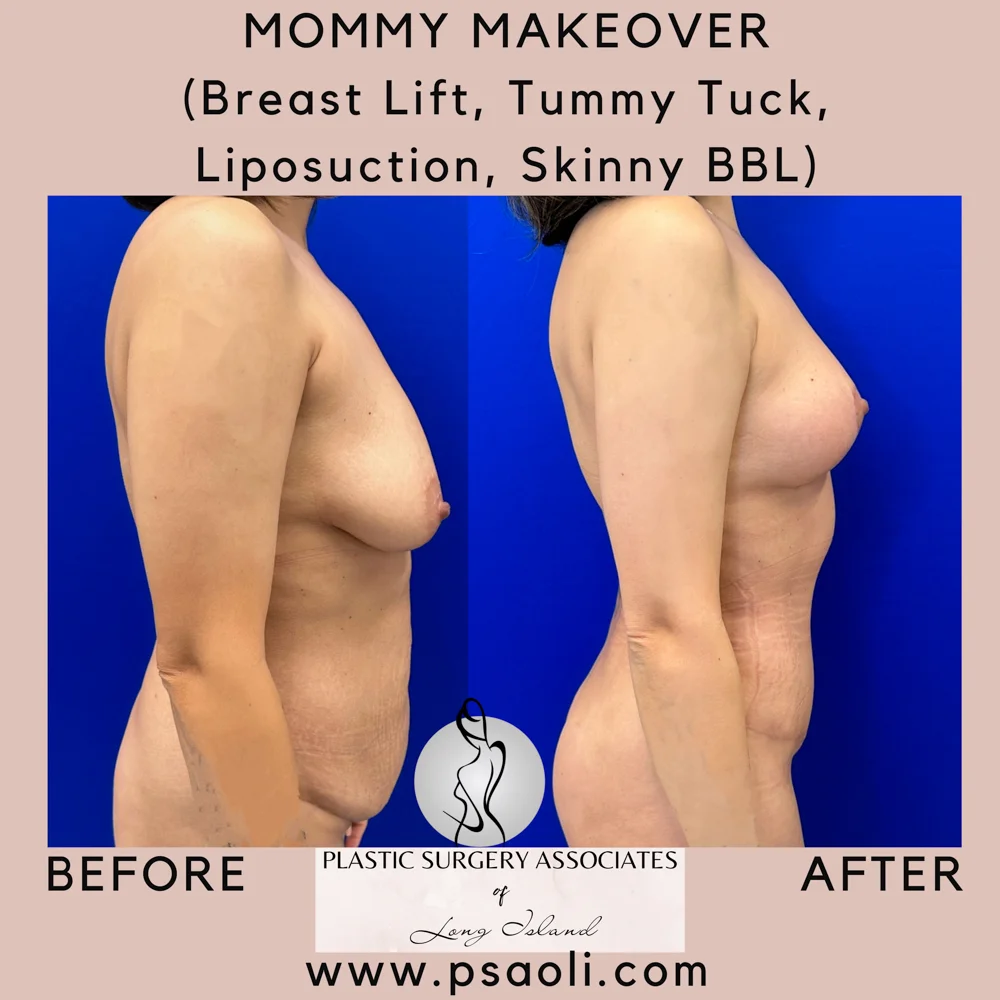 Pastel Pink Minimalist Quote Instagram Post – 5