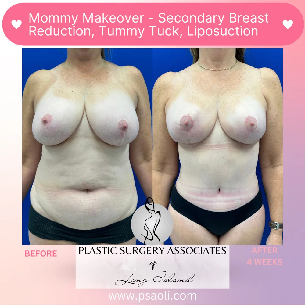 Pastel Pink Minimalist Skincare Reminder Instagram Post – 1