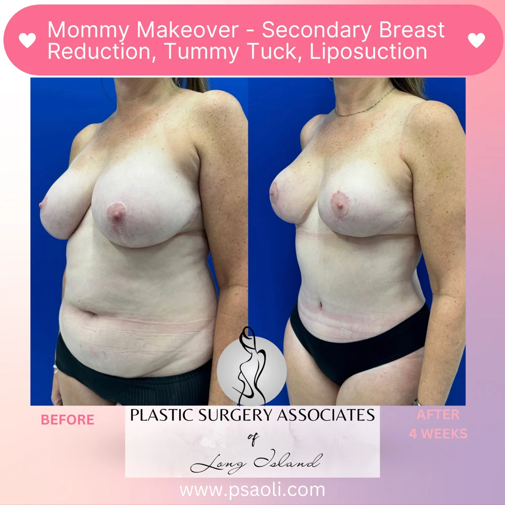 Pastel Pink Minimalist Skincare Reminder Instagram Post – 2