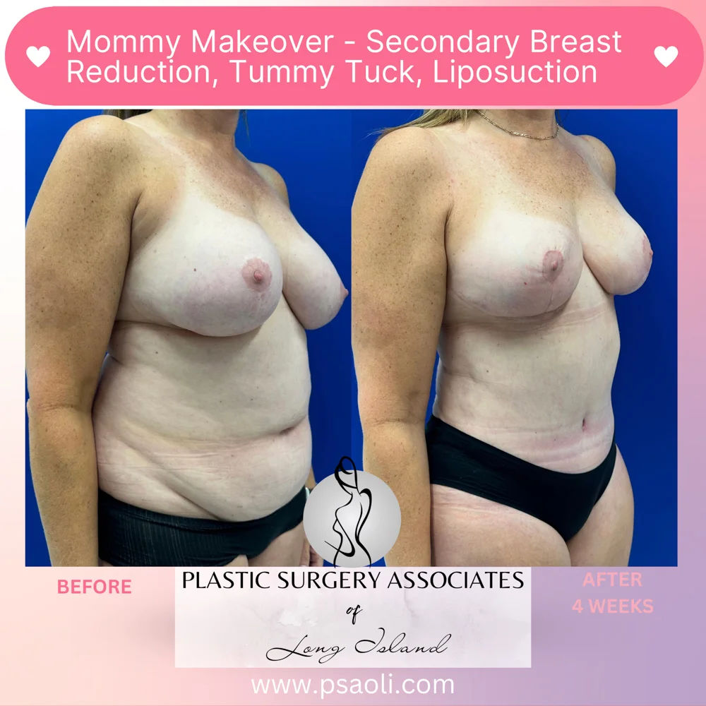 Pastel Pink Minimalist Skincare Reminder Instagram Post – 3