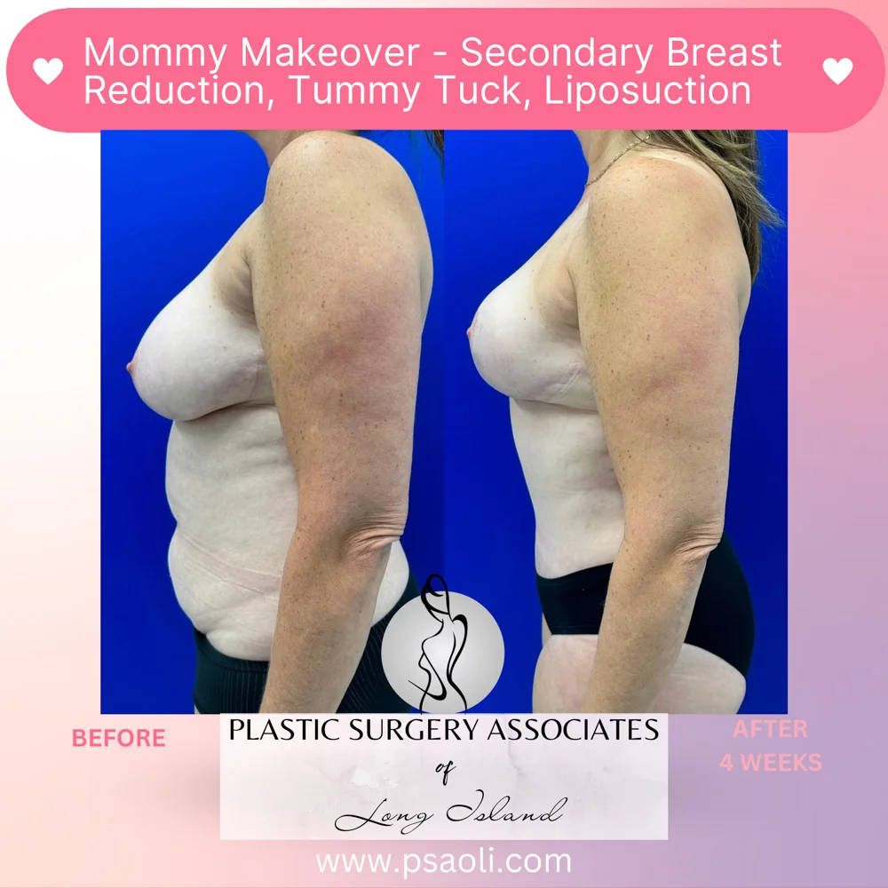 Pastel Pink Minimalist Skincare Reminder Instagram Post – 5