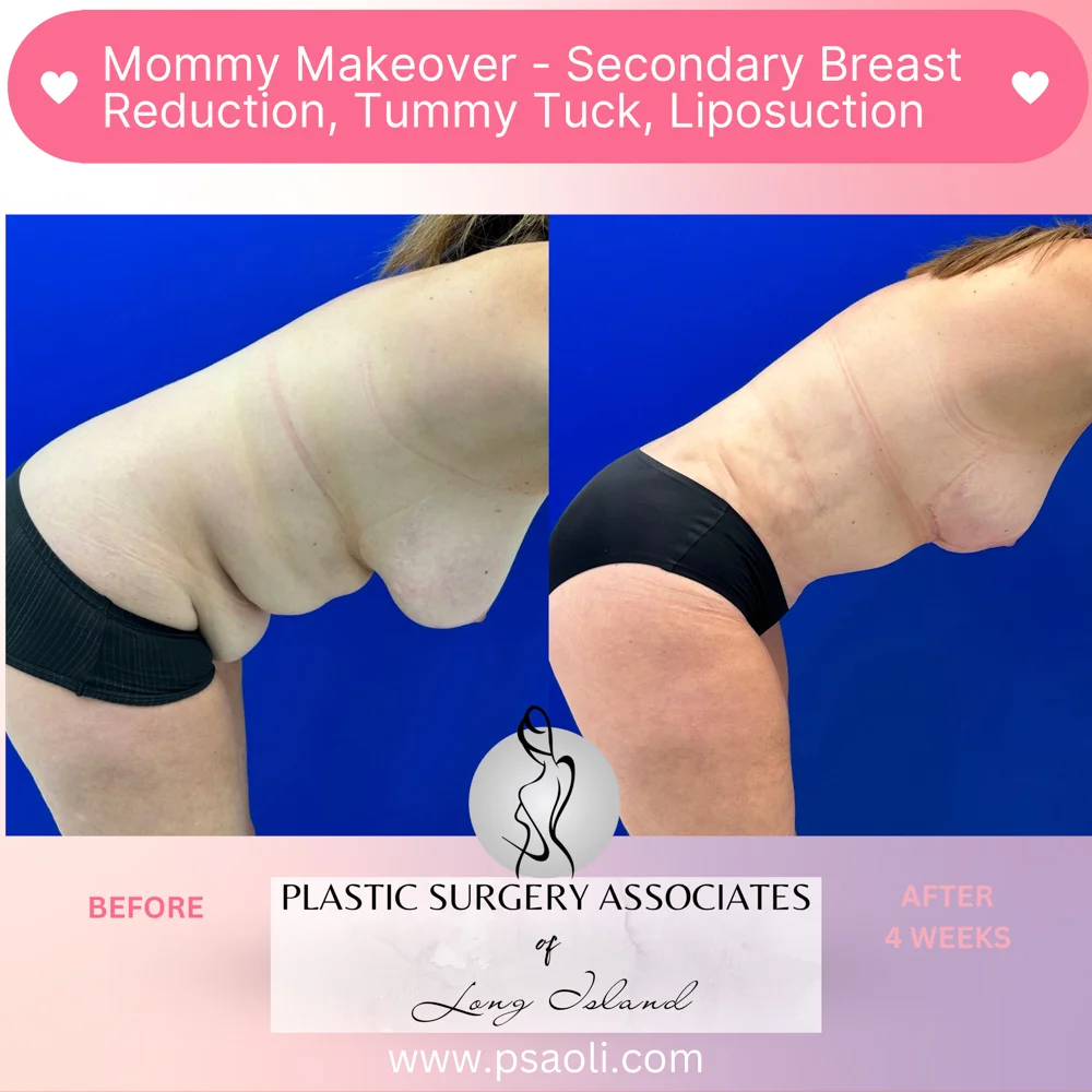 Pastel Pink Minimalist Skincare Reminder Instagram Post – 6