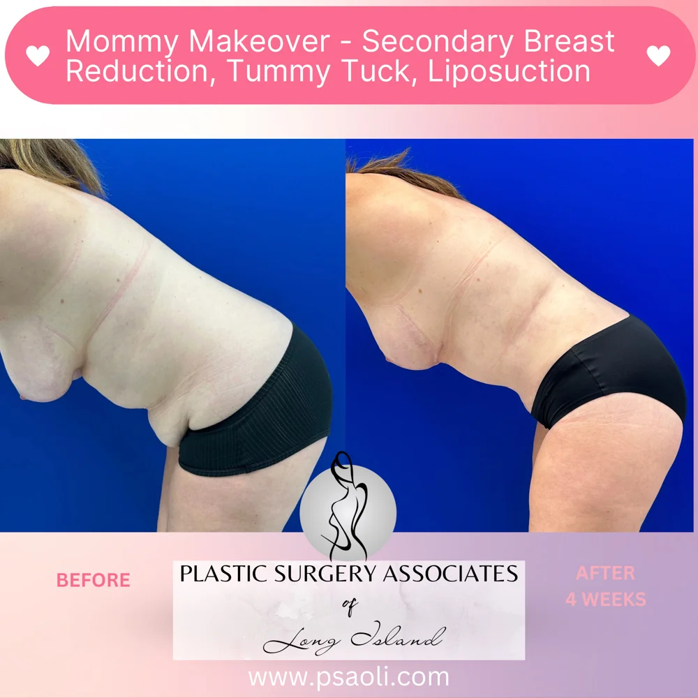 Pastel Pink Minimalist Skincare Reminder Instagram Post – 7