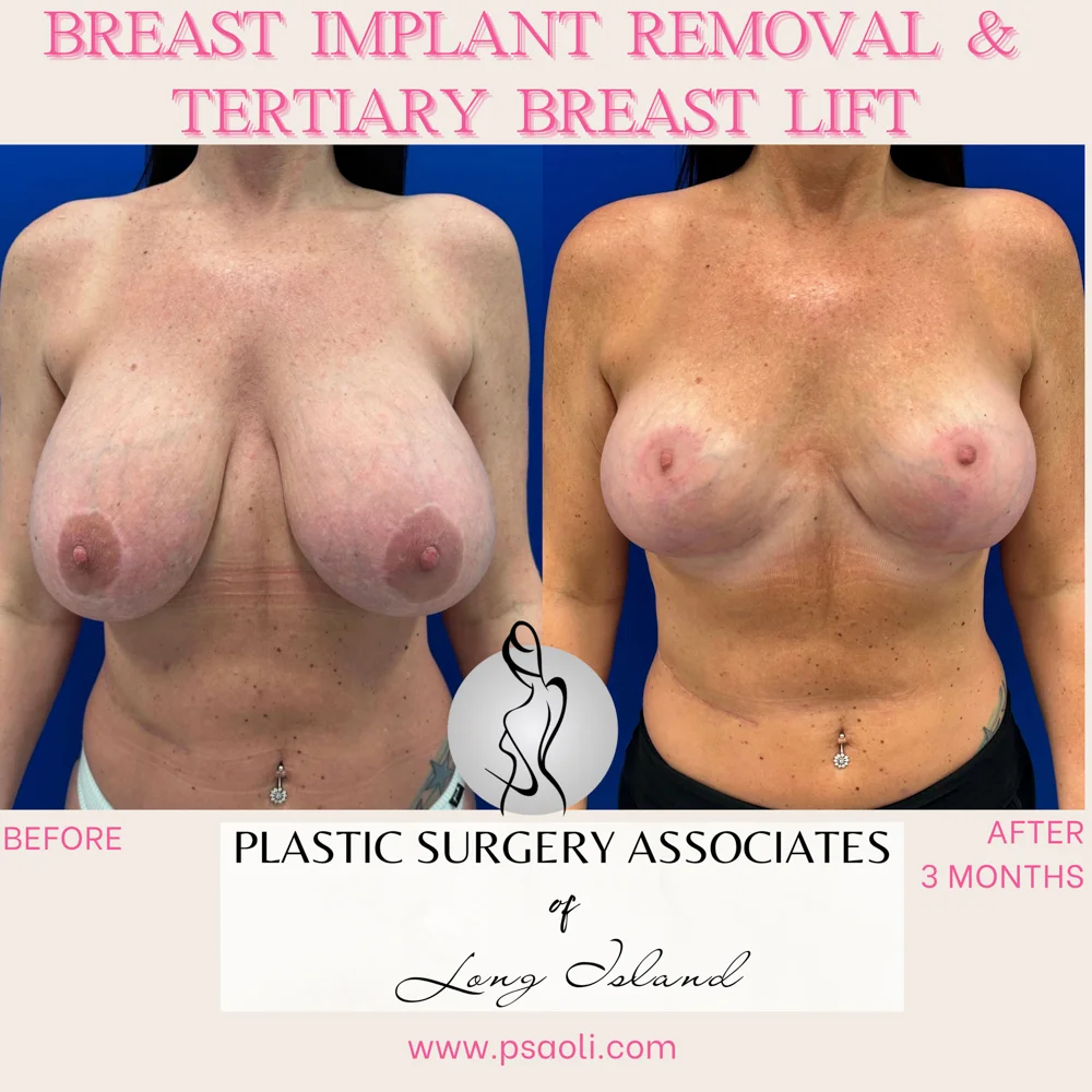 Personal Brand Instagram Post in Fuchsia Cream Classy Calligraphy Style – 1