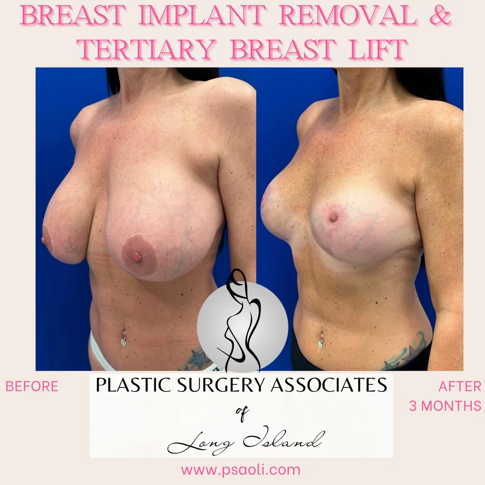 Personal Brand Instagram Post in Fuchsia Cream Classy Calligraphy Style – 2