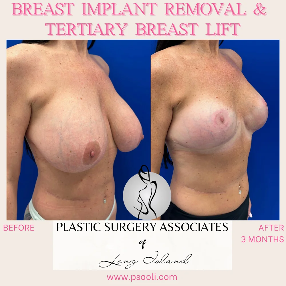 Personal Brand Instagram Post in Fuchsia Cream Classy Calligraphy Style – 3