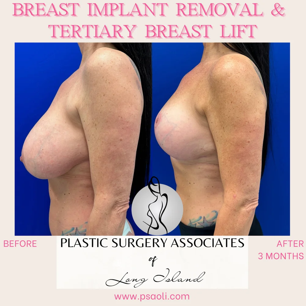 Personal Brand Instagram Post in Fuchsia Cream Classy Calligraphy Style – 4