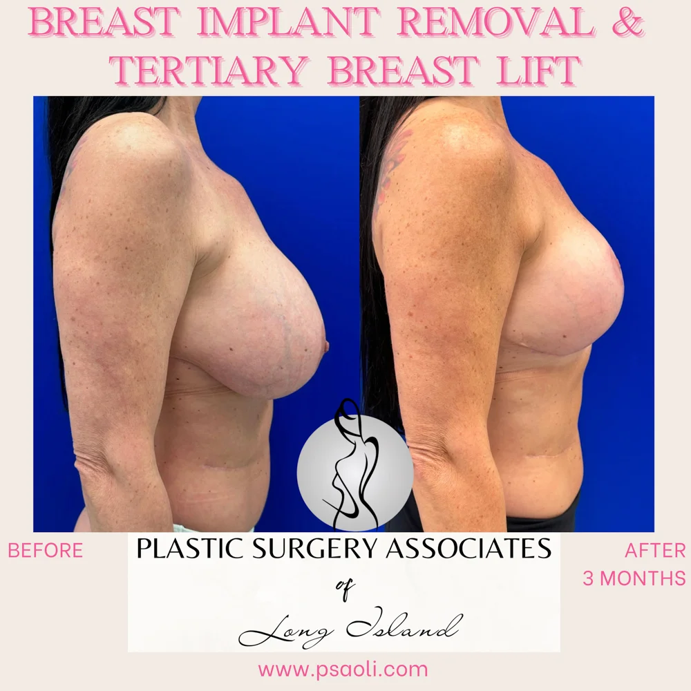 Personal Brand Instagram Post in Fuchsia Cream Classy Calligraphy Style – 5