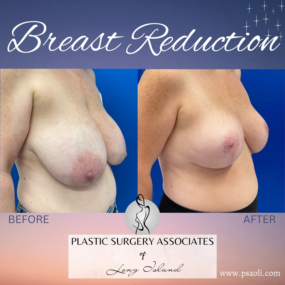 Pink & Purple Gradient Fun Chocolate Chat Animated Social Media – 2