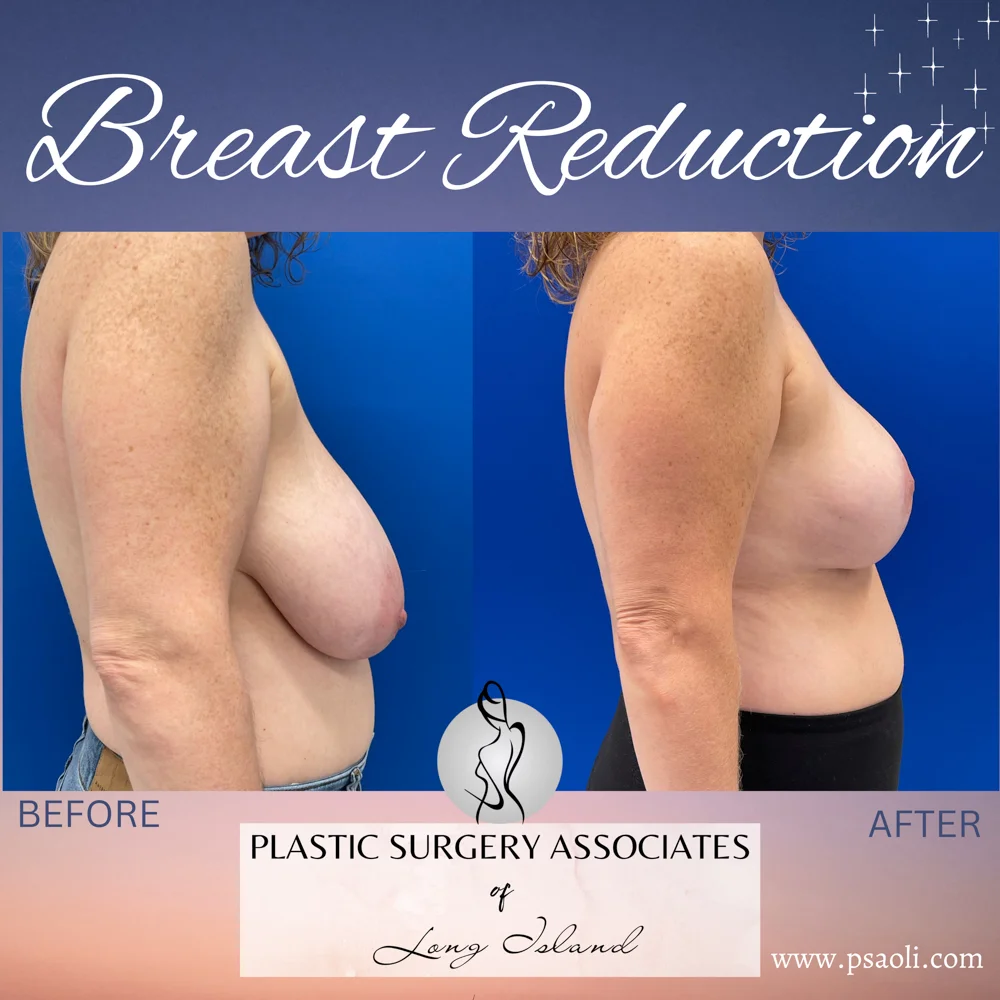 Pink & Purple Gradient Fun Chocolate Chat Animated Social Media – 4