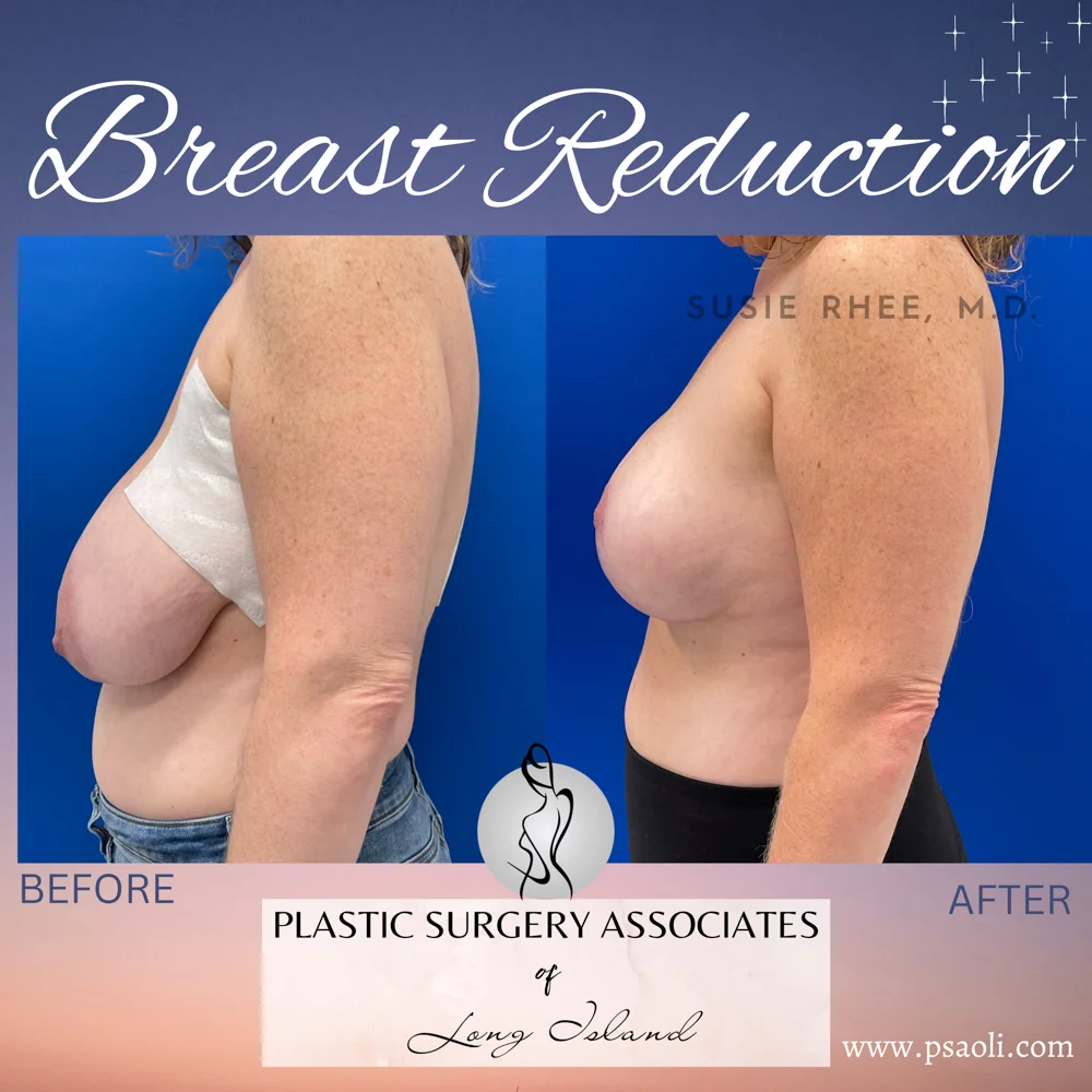 Pink & Purple Gradient Fun Chocolate Chat Animated Social Media – 5