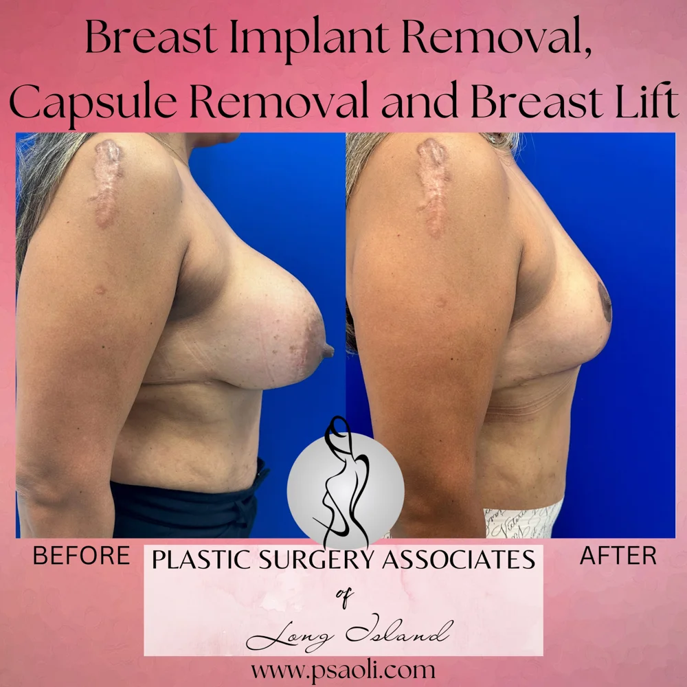 Pink Watercolor Motivational Quote Instagram Post (Square) – 5