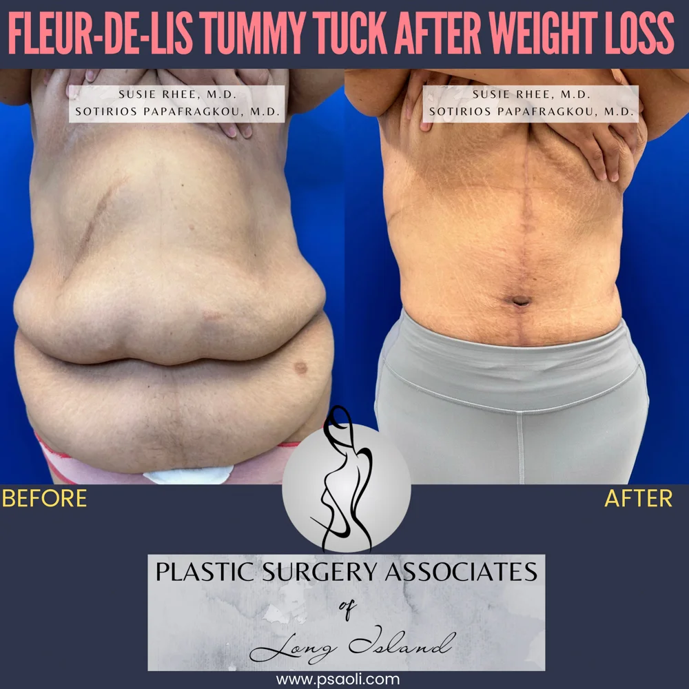 Pink and Black Duo Tone Seamless Carousel Instagram Post – 1