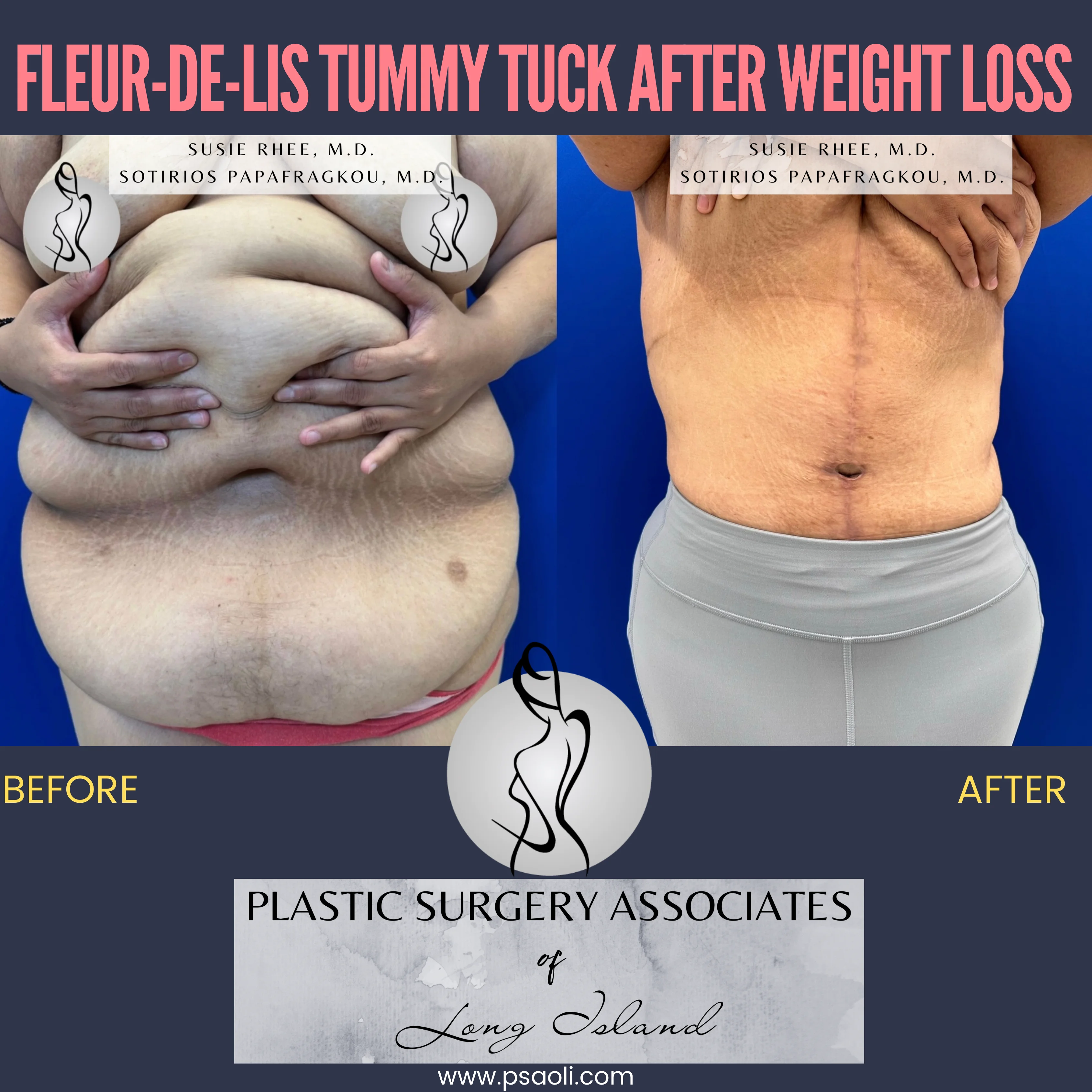 Pink and Black Duo Tone Seamless Carousel Instagram Post – 2