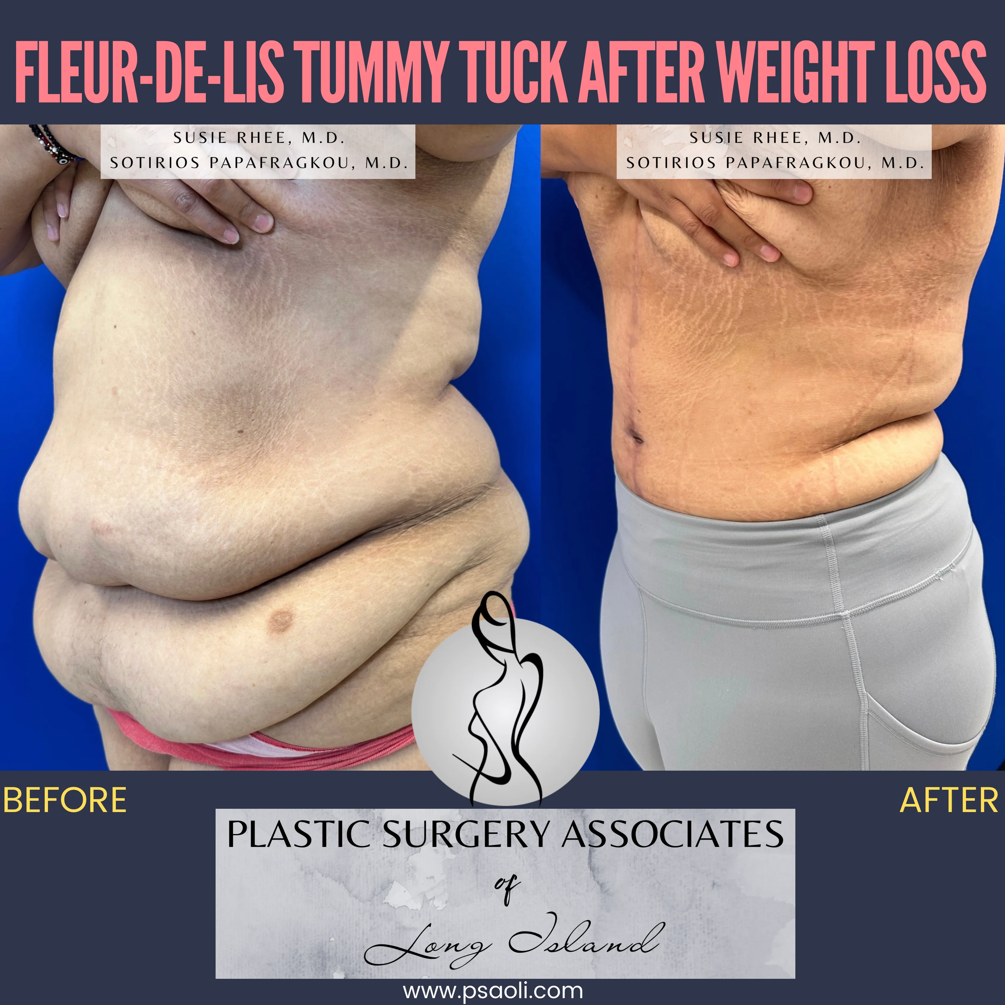 Pink and Black Duo Tone Seamless Carousel Instagram Post – 3