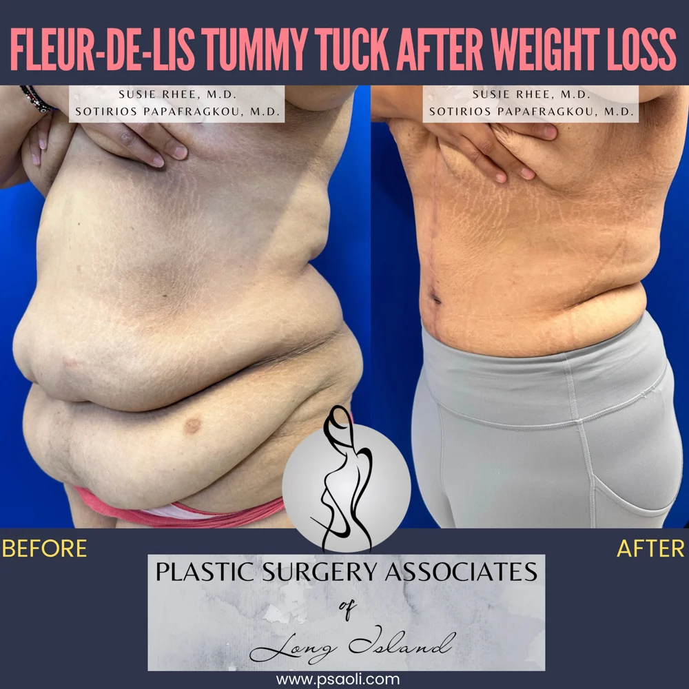 Pink and Black Duo Tone Seamless Carousel Instagram Post – 3