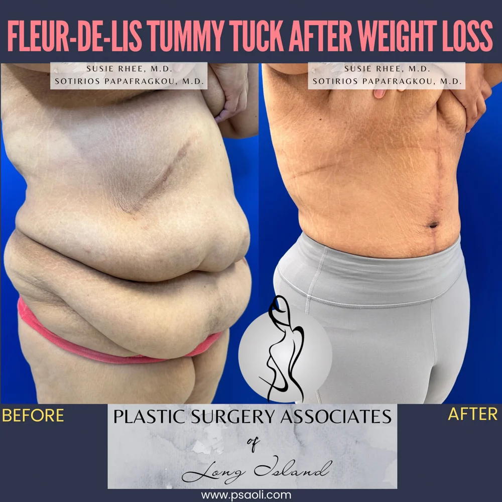 Pink and Black Duo Tone Seamless Carousel Instagram Post – 4