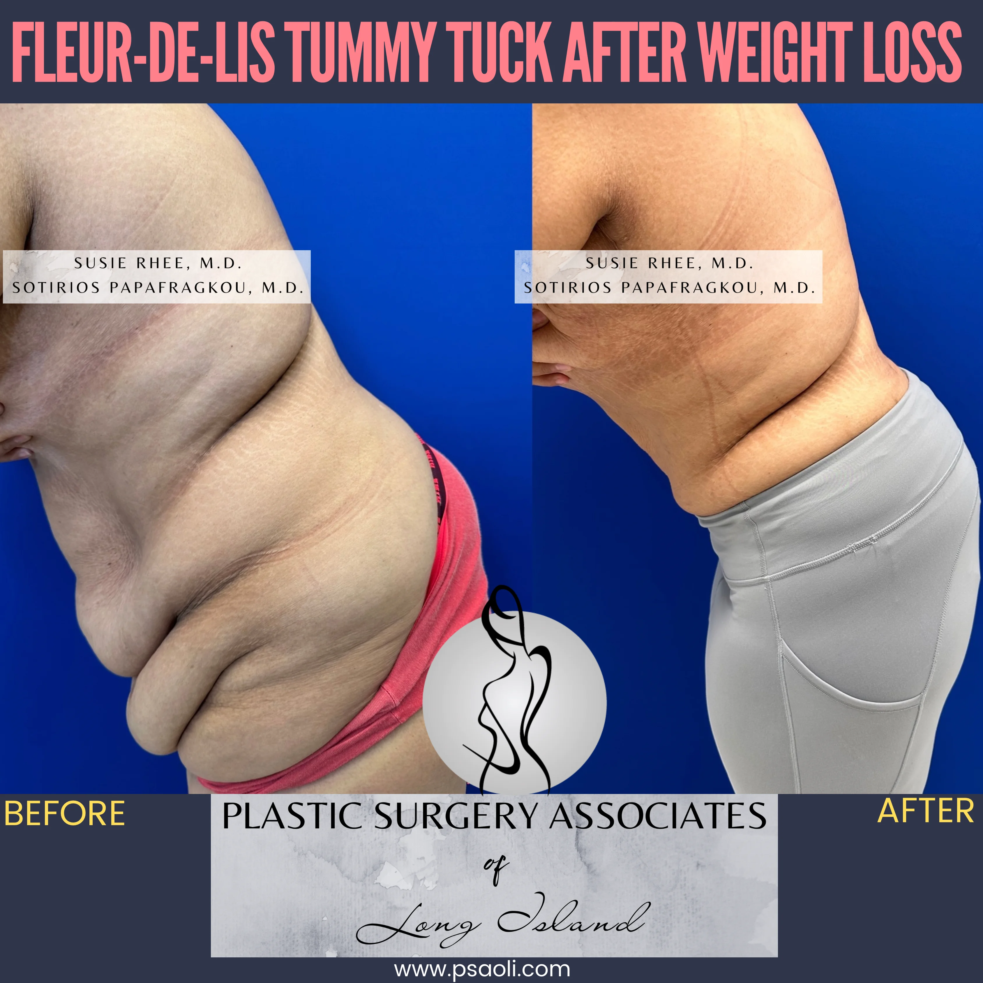 Pink and Black Duo Tone Seamless Carousel Instagram Post – 5