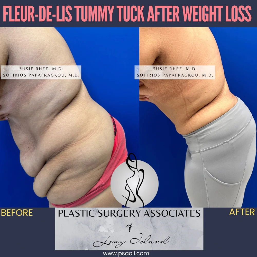 Pink and Black Duo Tone Seamless Carousel Instagram Post – 5