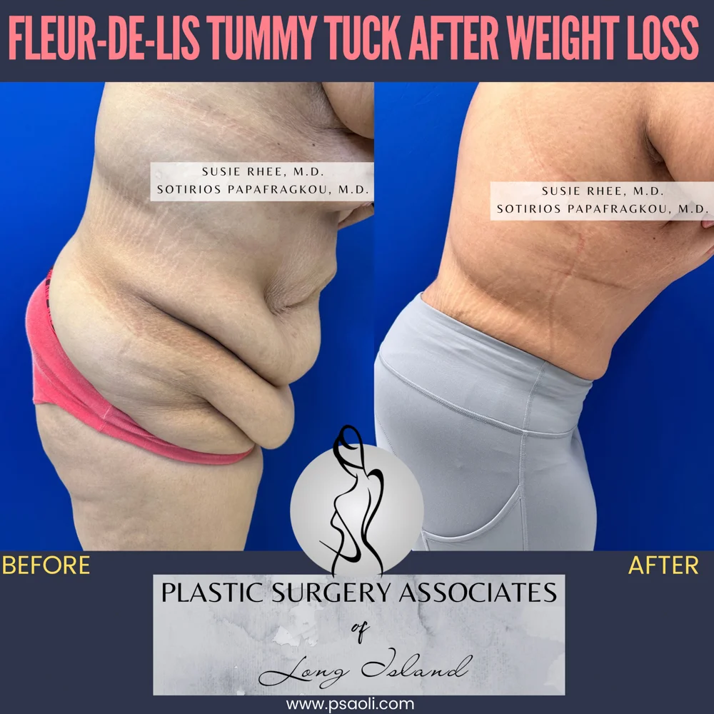 Pink and Black Duo Tone Seamless Carousel Instagram Post – 6