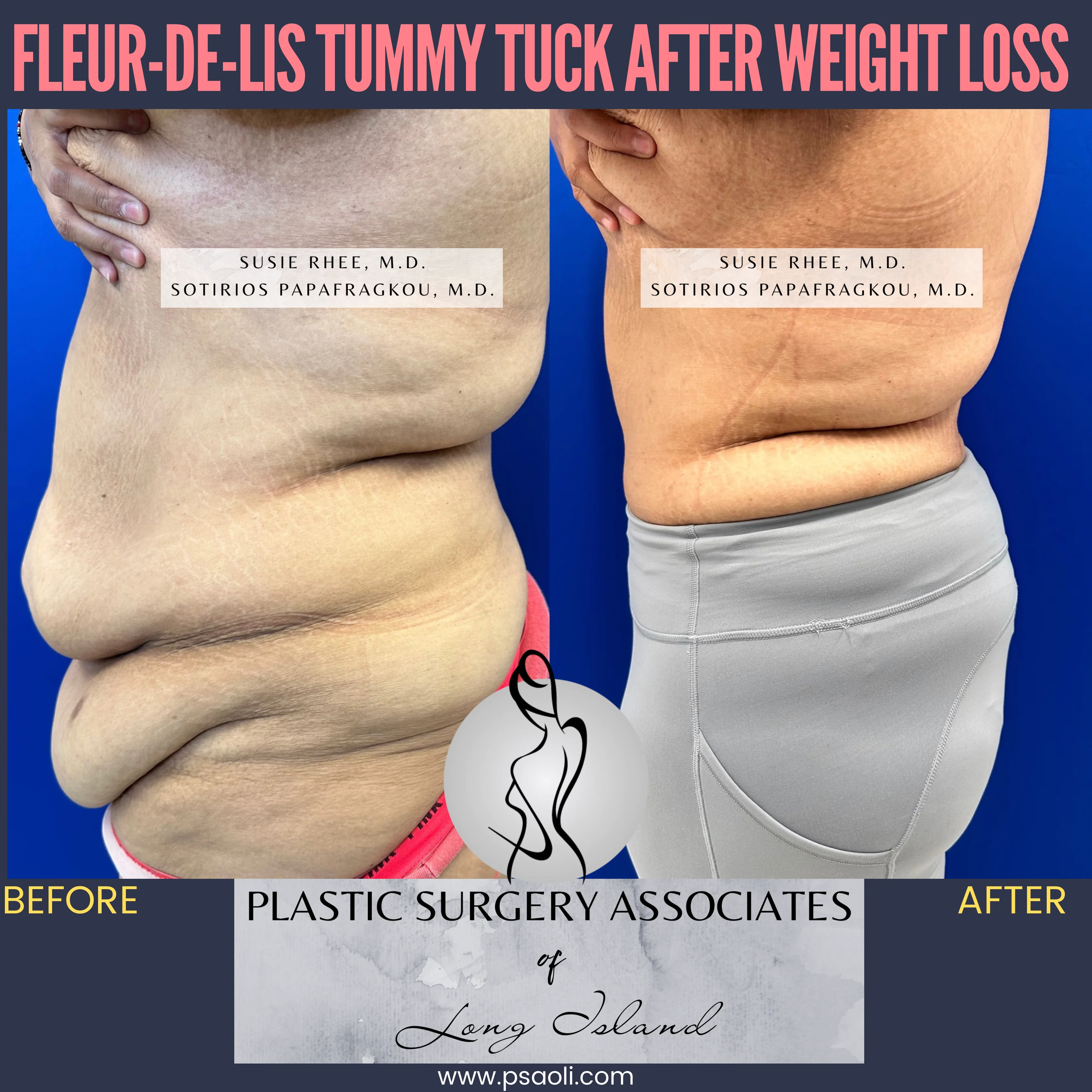 Pink and Black Duo Tone Seamless Carousel Instagram Post – 7