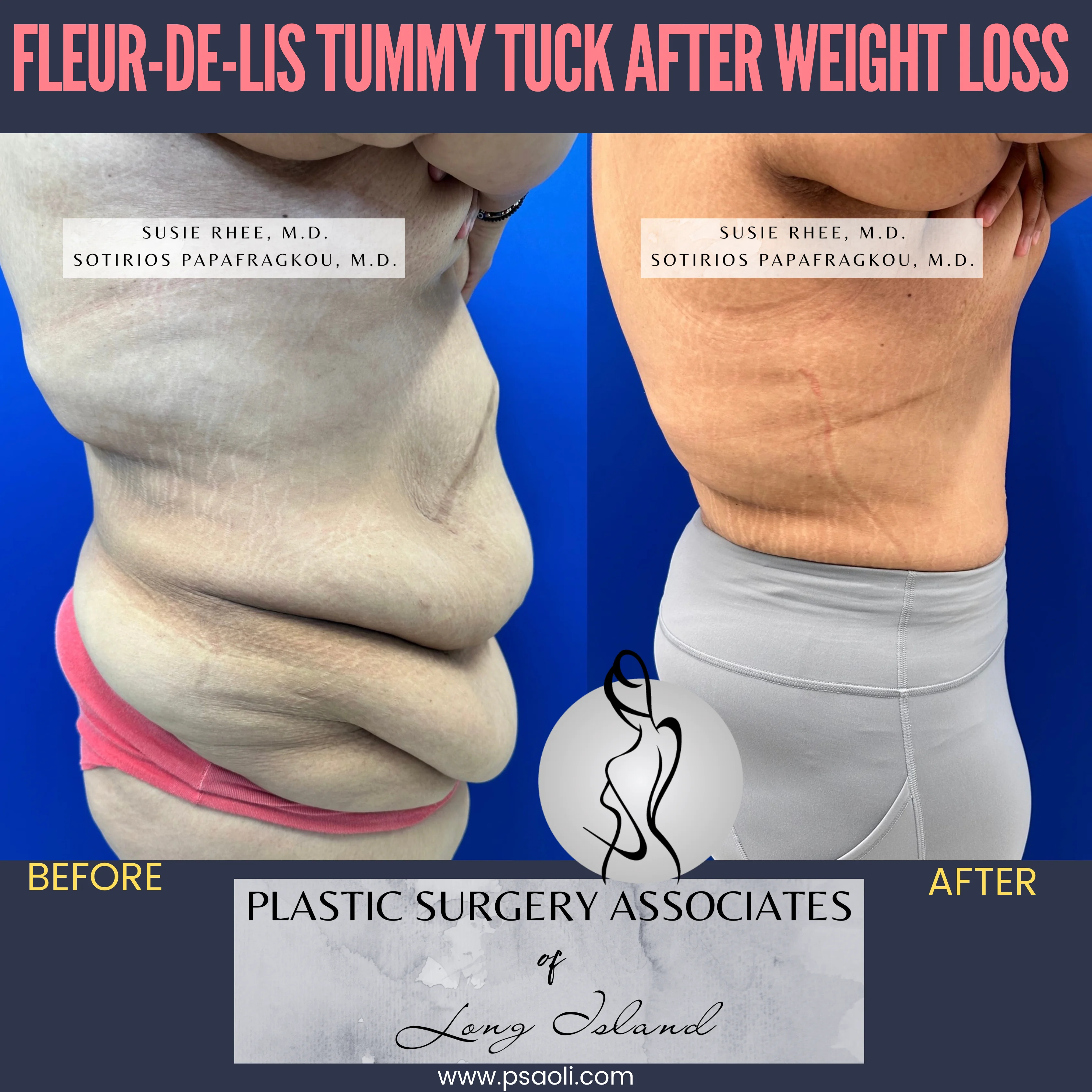 Pink and Black Duo Tone Seamless Carousel Instagram Post – 8