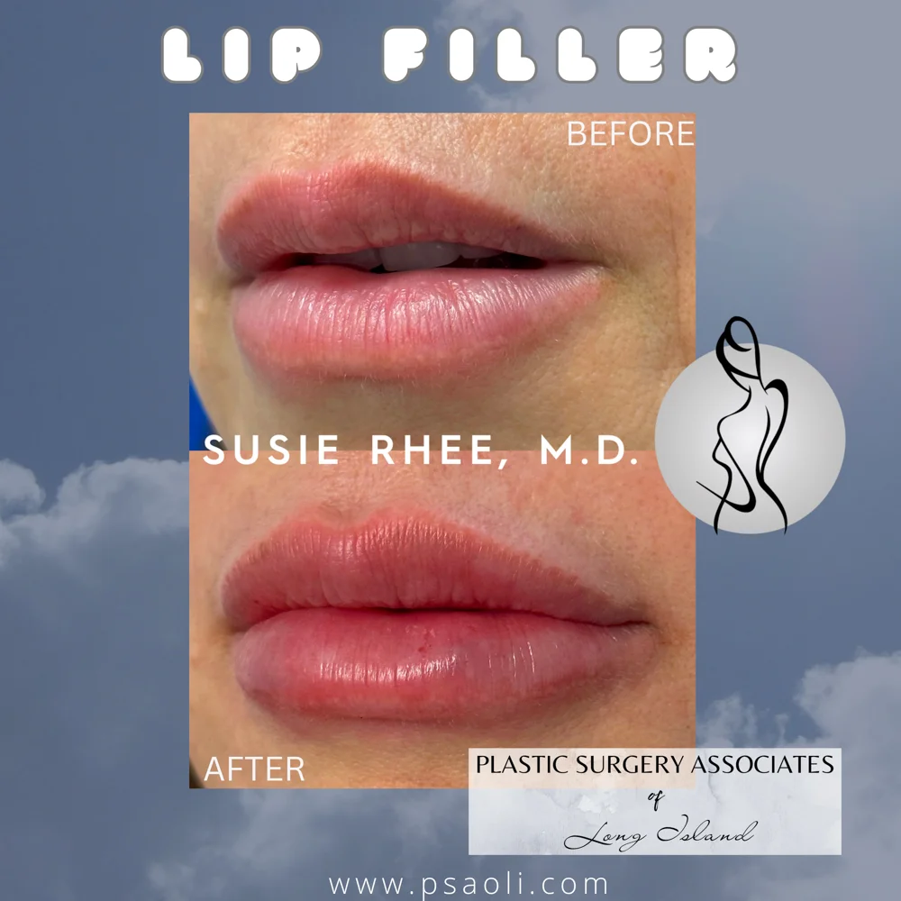 Simple Minimalist Instagram Post Peace Quote with Sky and Dove Bird – 1