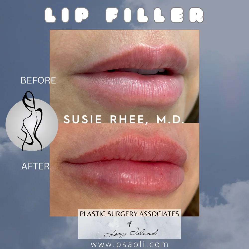 Simple Minimalist Instagram Post Peace Quote with Sky and Dove Bird – 2