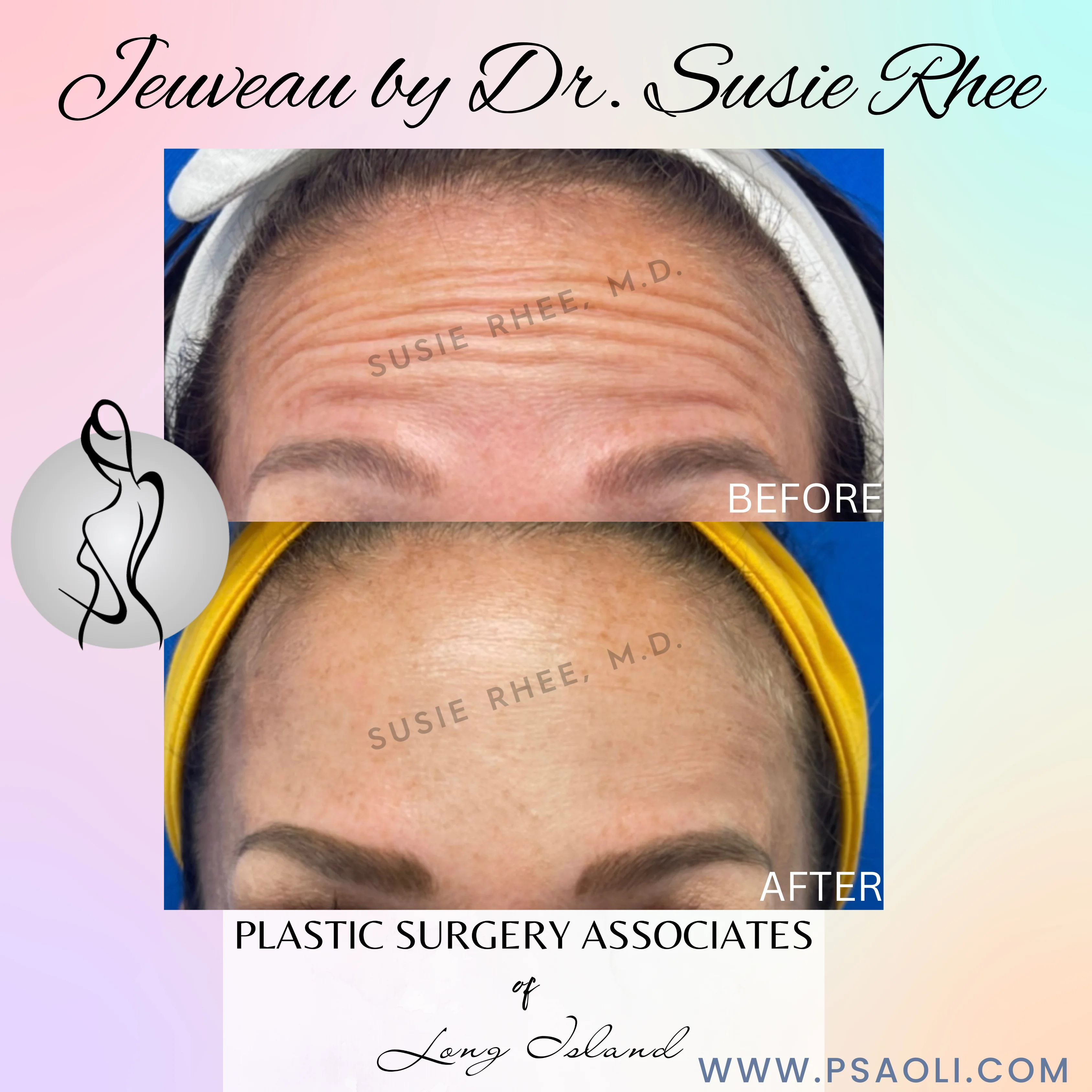 Simple Quote Gradient Instagram Posts – 1