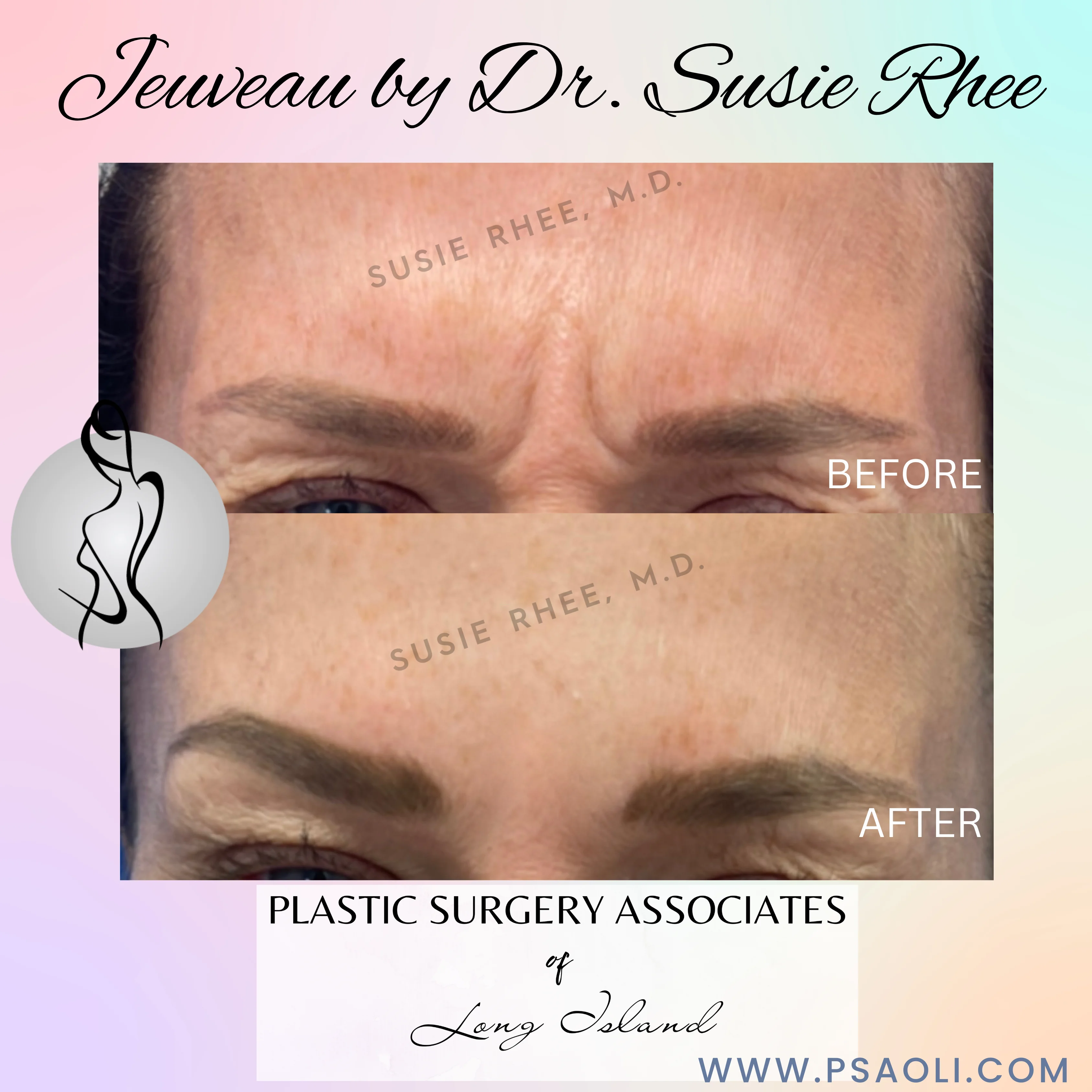 Simple Quote Gradient Instagram Posts – 2