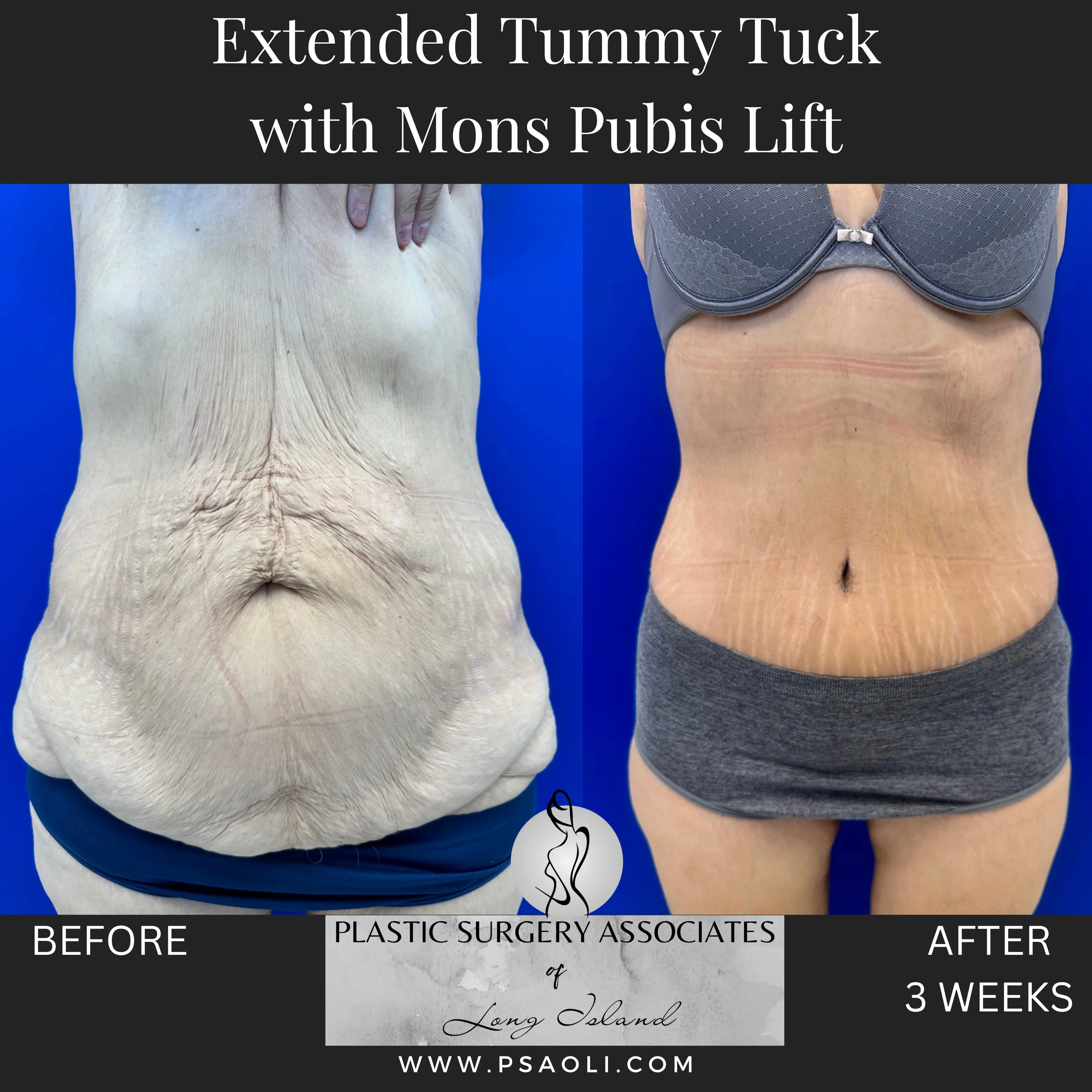 Timeless Minimalist Instagram Post – 1