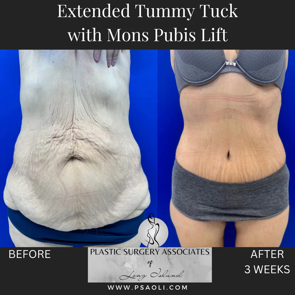 Timeless Minimalist Instagram Post – 1