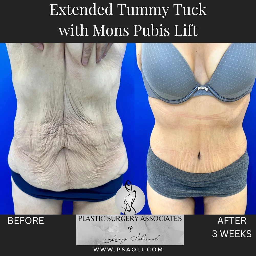 Timeless Minimalist Instagram Post – 2