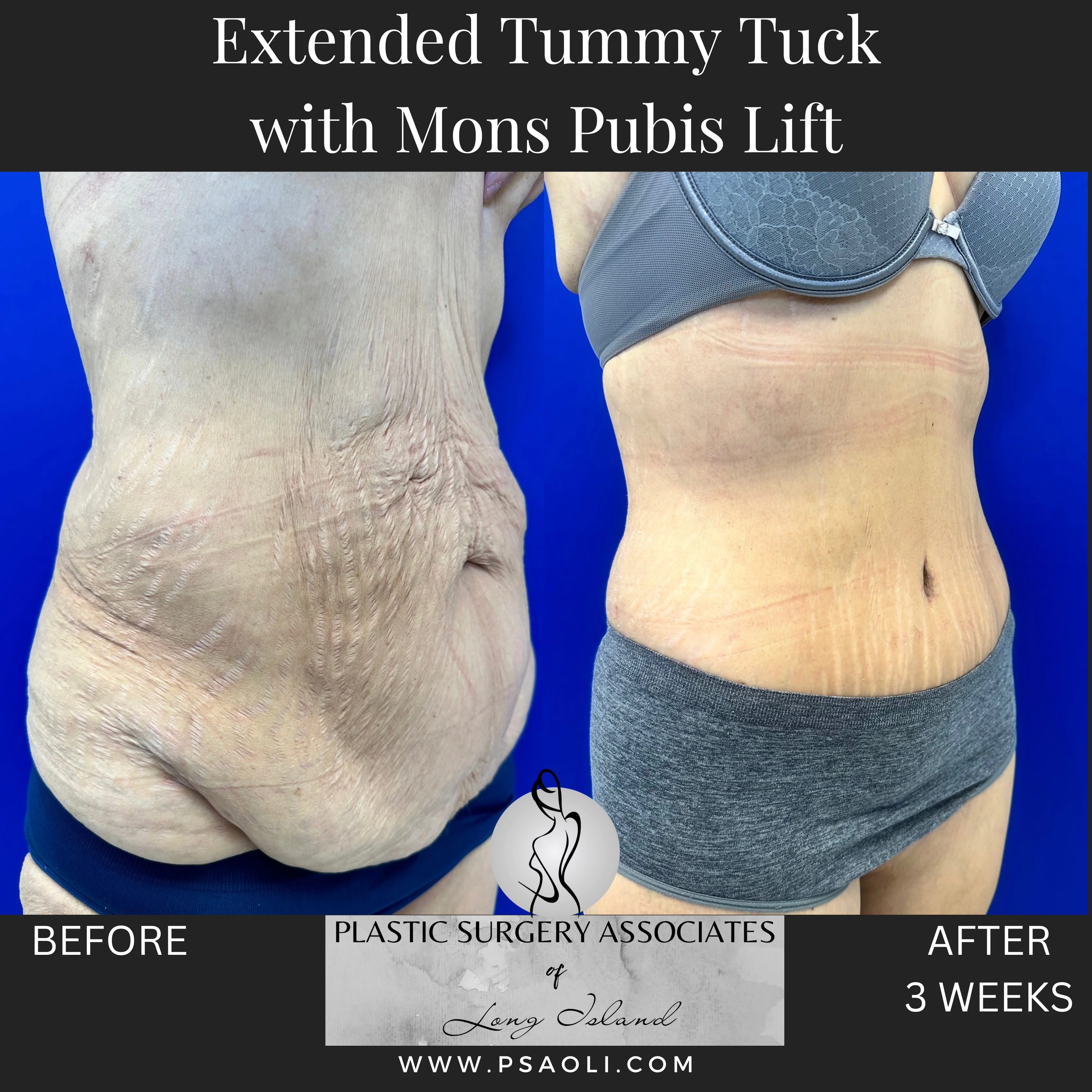 Timeless Minimalist Instagram Post – 3