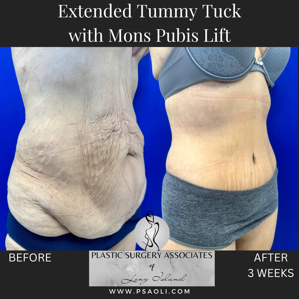 Timeless Minimalist Instagram Post – 3