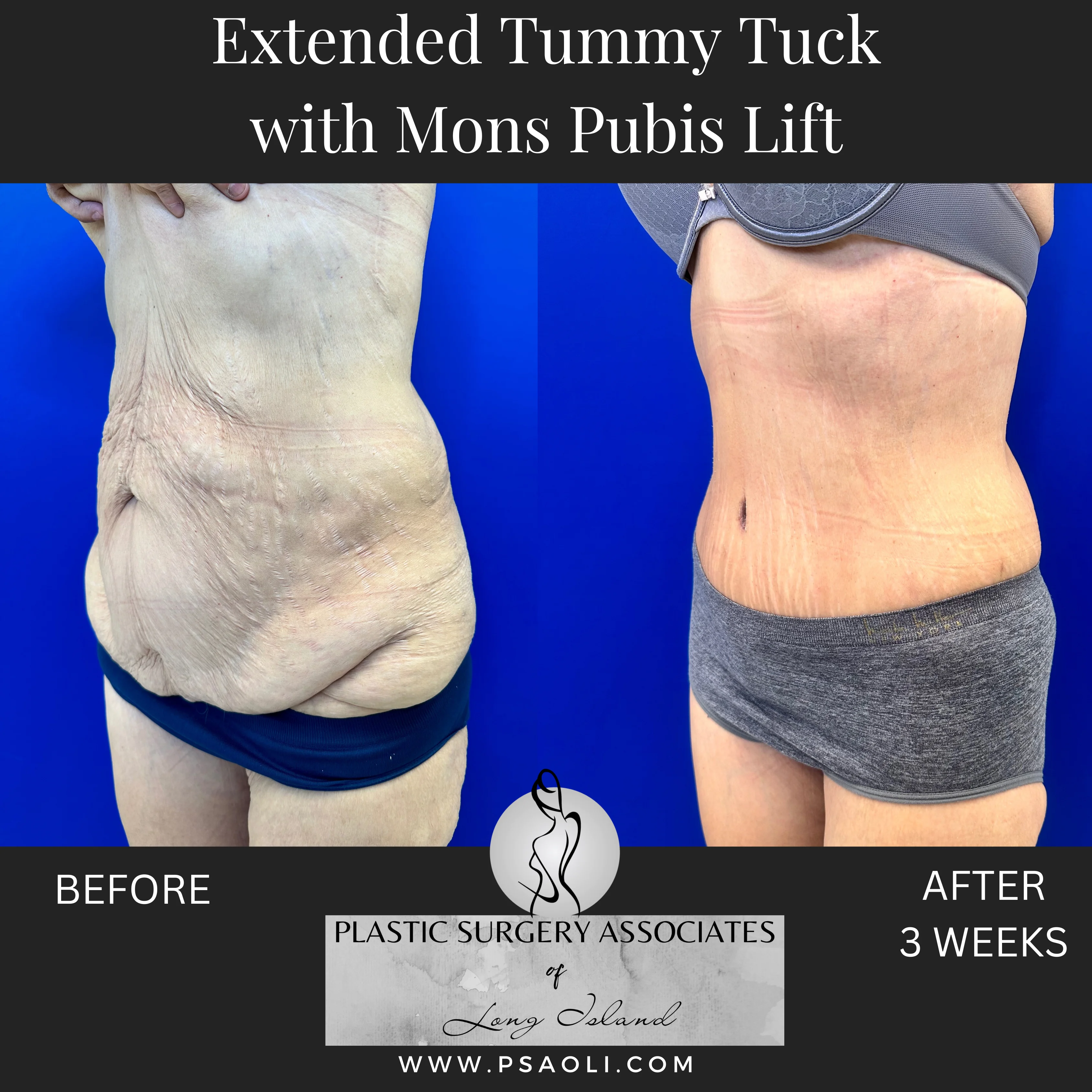 Timeless Minimalist Instagram Post – 4