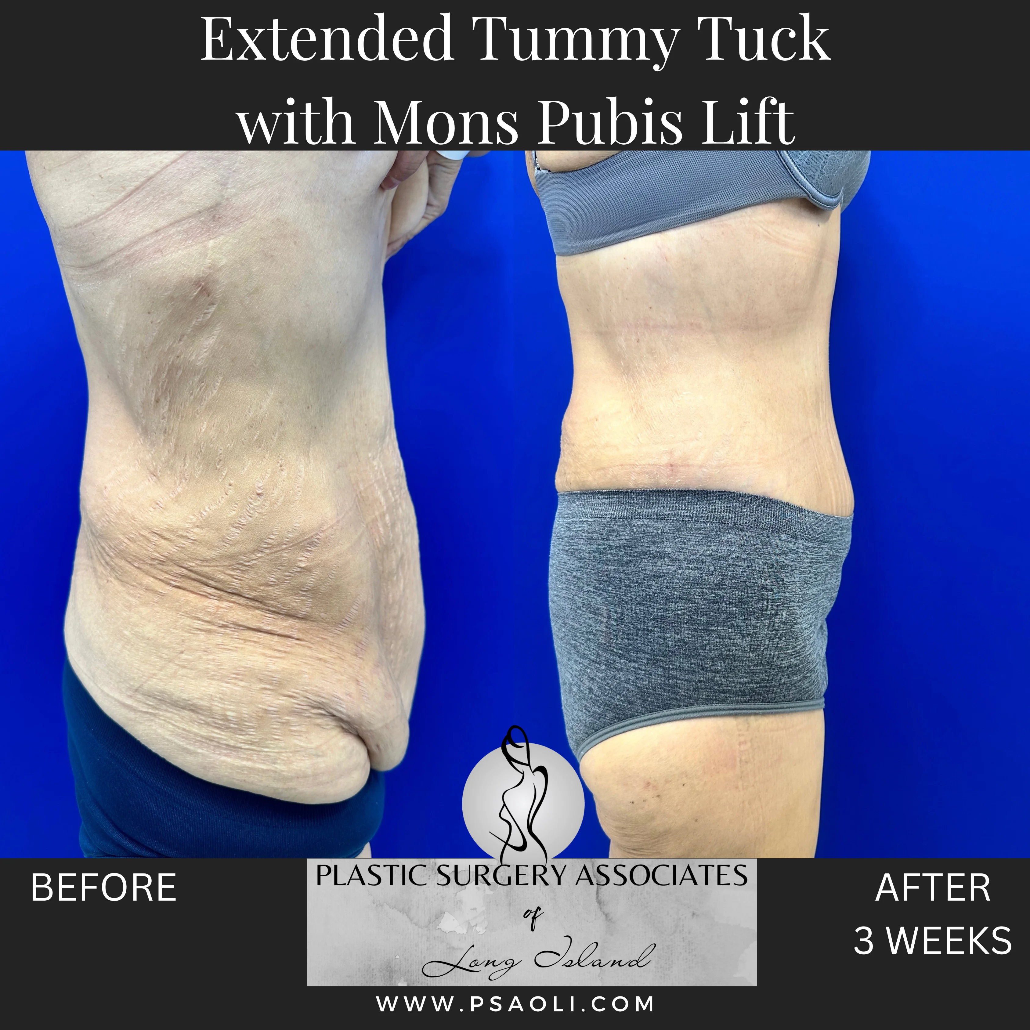 Timeless Minimalist Instagram Post – 5