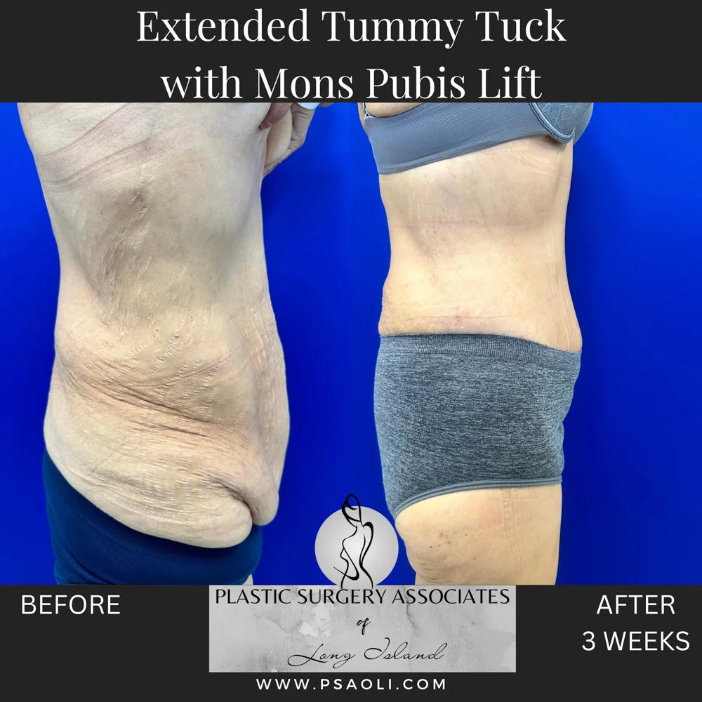 Timeless Minimalist Instagram Post – 5