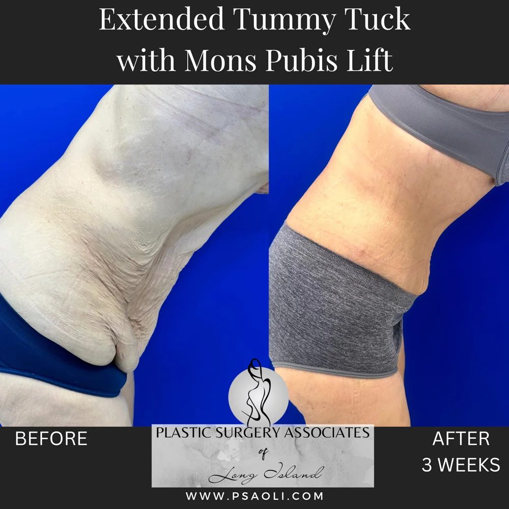 Timeless Minimalist Instagram Post – 6