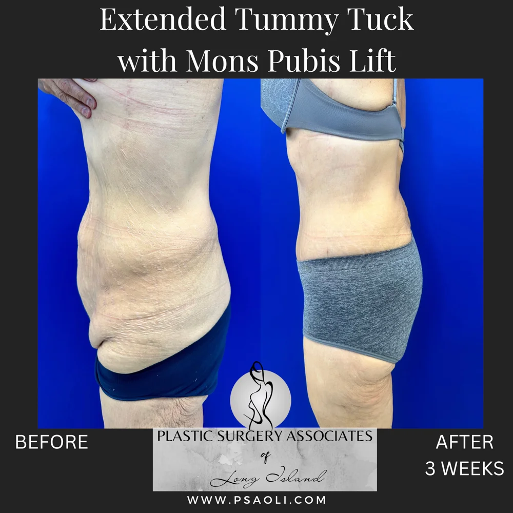 Timeless Minimalist Instagram Post – 7