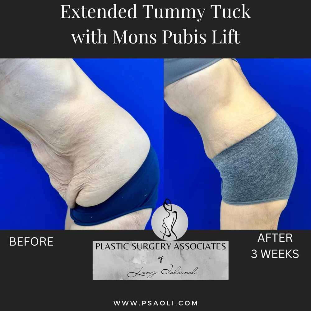 Timeless Minimalist Instagram Post – 8