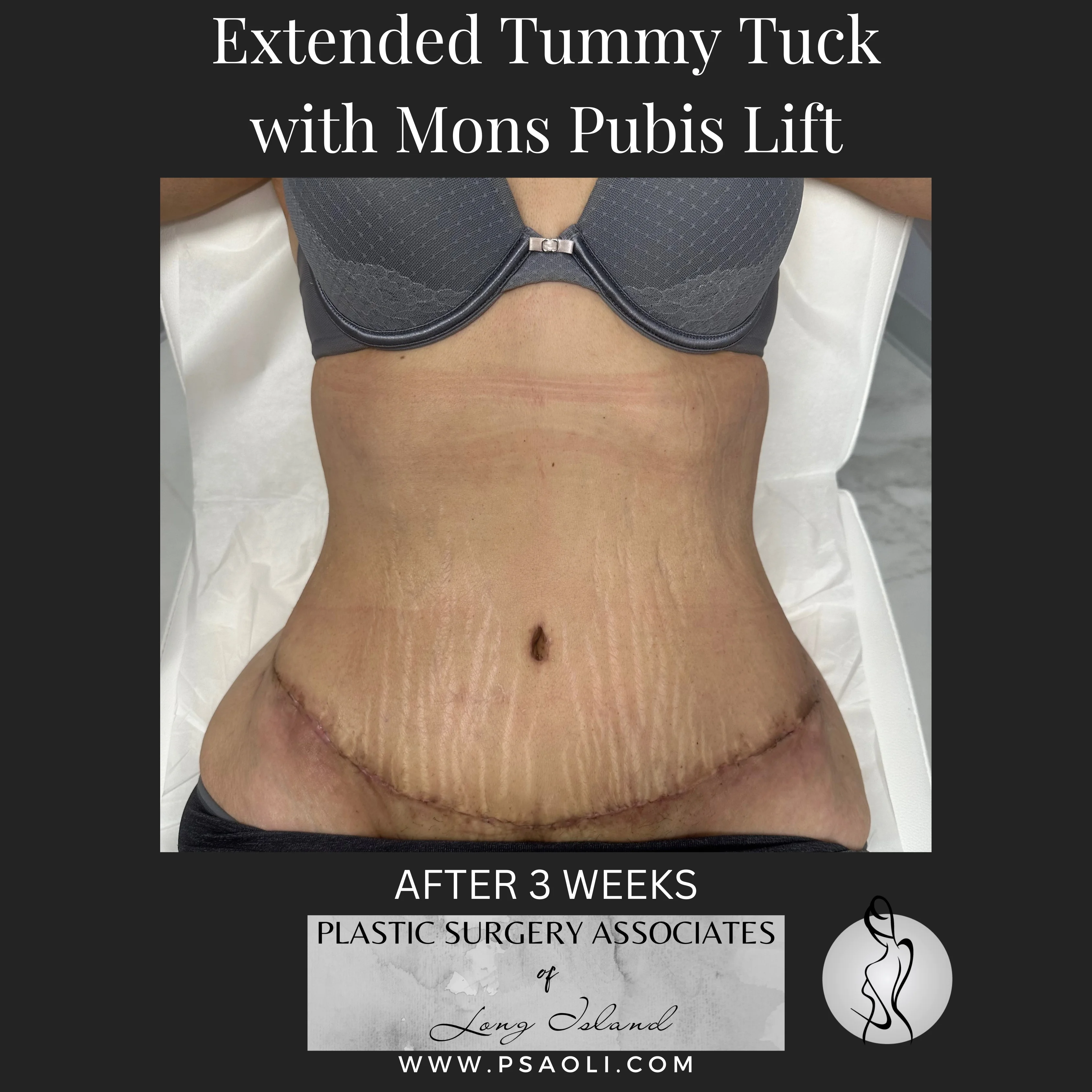 Timeless Minimalist Instagram Post – 9