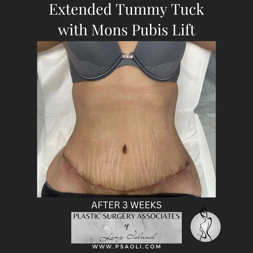 Timeless Minimalist Instagram Post – 9