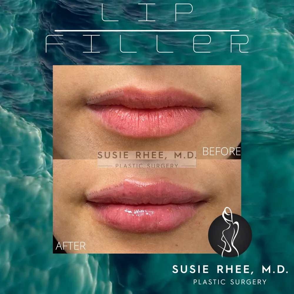 Turquoise Teal Blue Ocean Sound Waves Audio Animated Social Media Instagram Video – 1