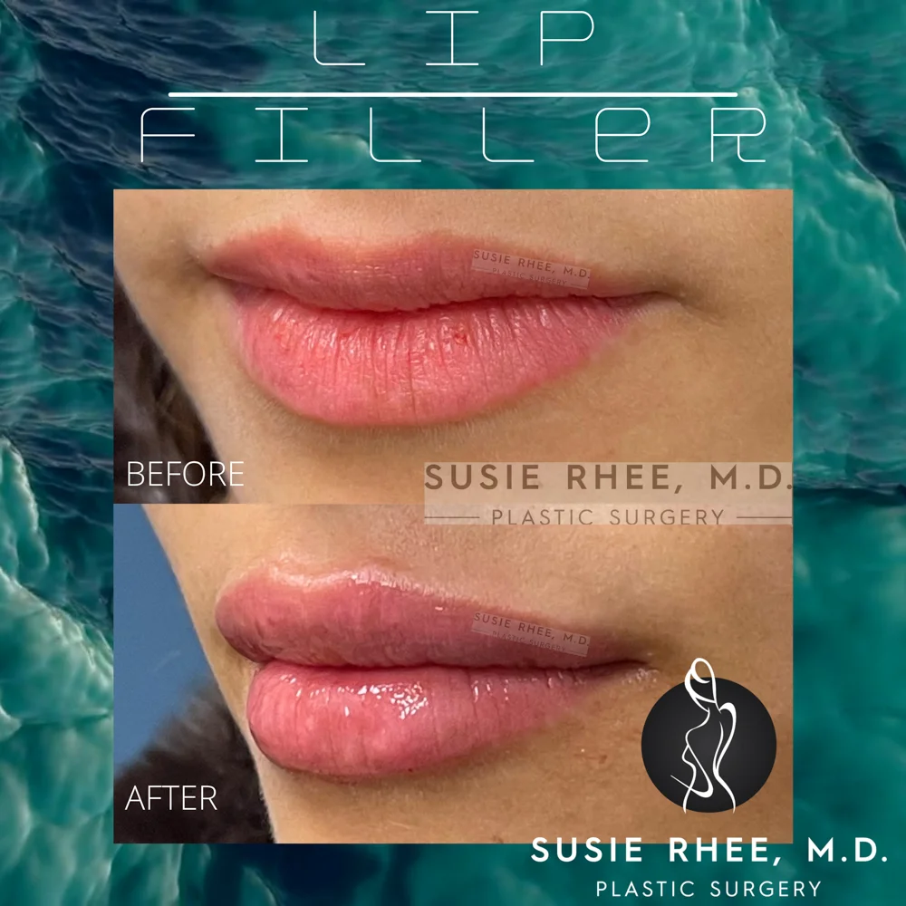 Turquoise Teal Blue Ocean Sound Waves Audio Animated Social Media Instagram Video – 2