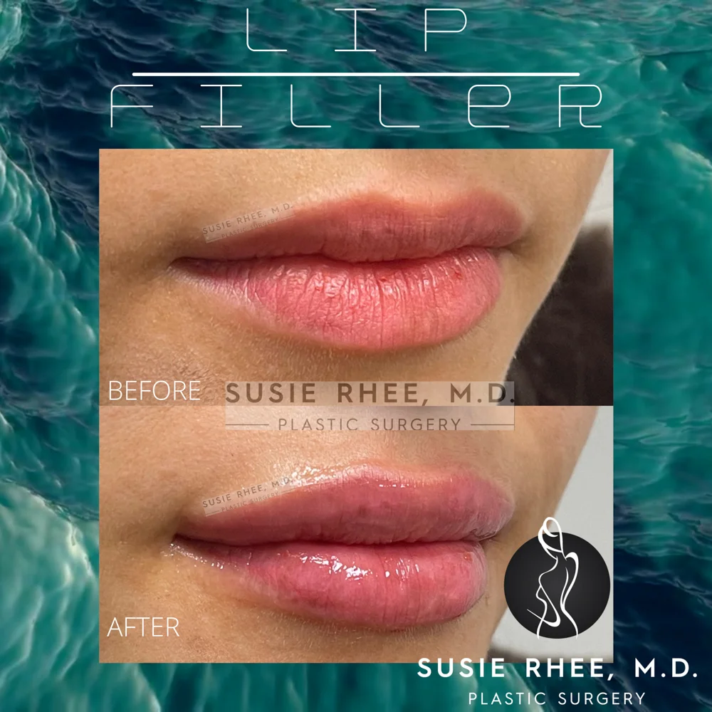 Turquoise Teal Blue Ocean Sound Waves Audio Animated Social Media Instagram Video – 3