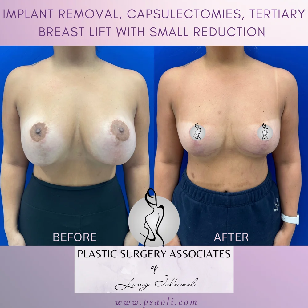 Untitled (Instagram Post (Square)) – 1