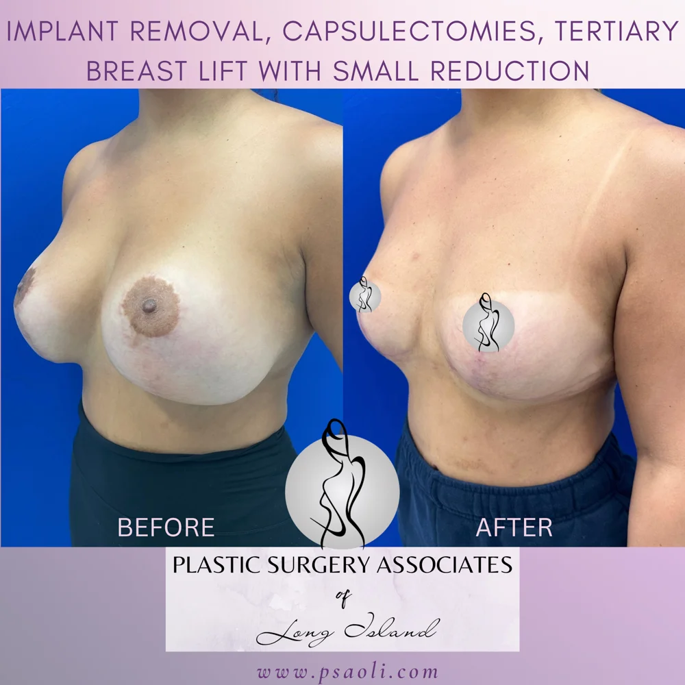 Untitled (Instagram Post (Square)) – 2