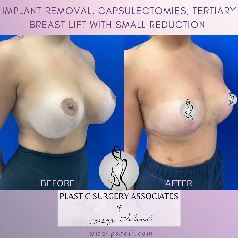 Untitled (Instagram Post (Square)) – 3