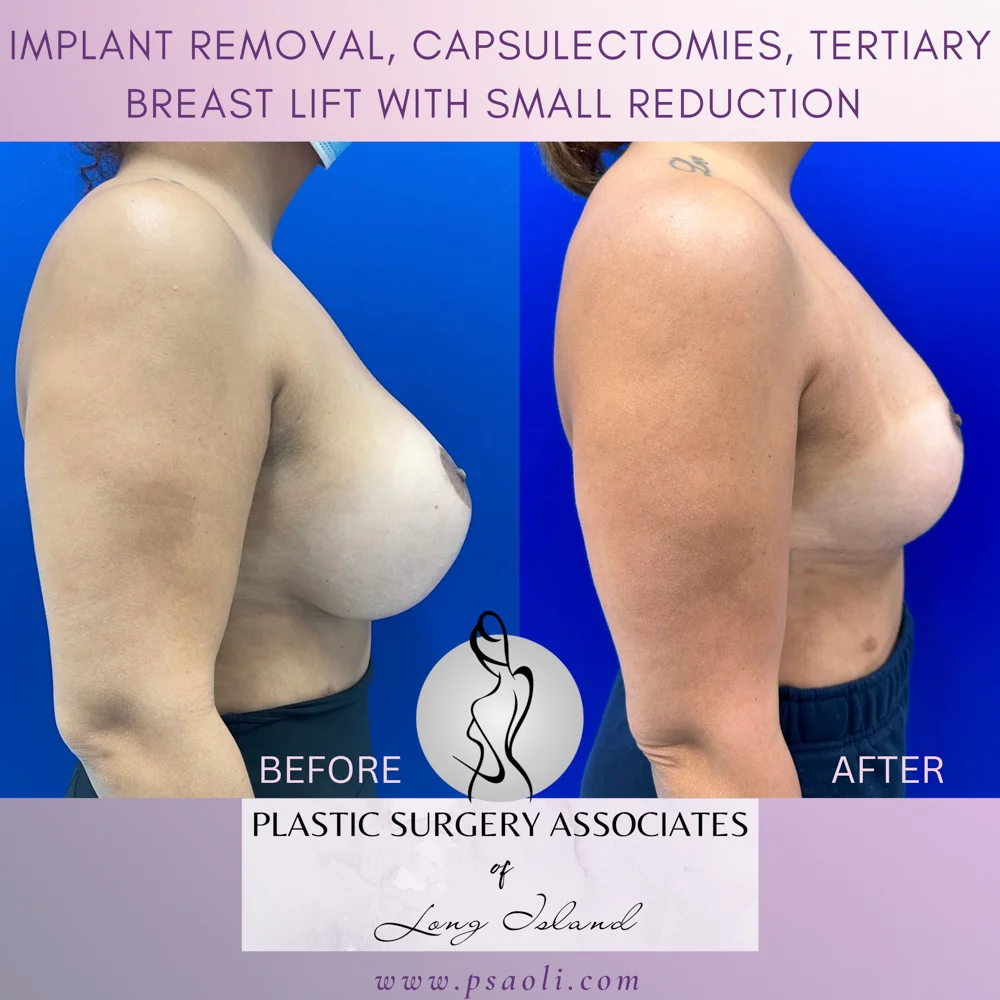 Untitled (Instagram Post (Square)) – 4